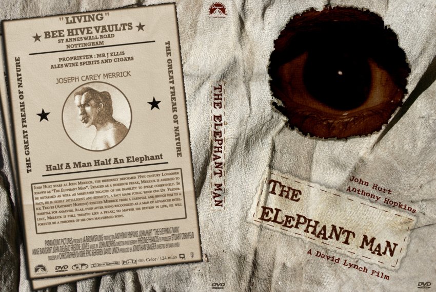 The Elephant Man